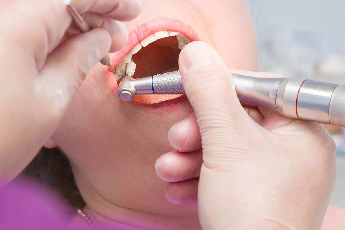 Diş Taşı Temizliği ve Ağız Bakımı